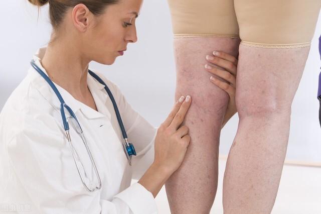 脚踝浮肿是什么原因引起的老年人（女性脚踝浮肿是什么原因引起的怎么治疗）